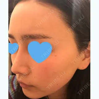 664日目の経過画像（1枚目）