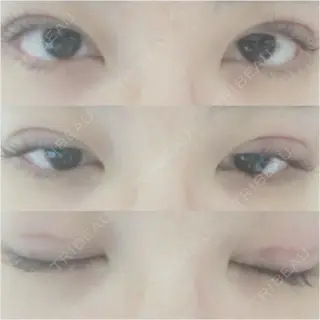 1日目の経過画像（1枚目）
