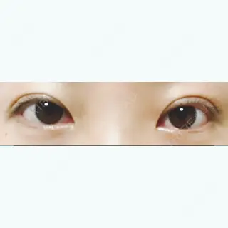 61日目の経過画像（2枚目）