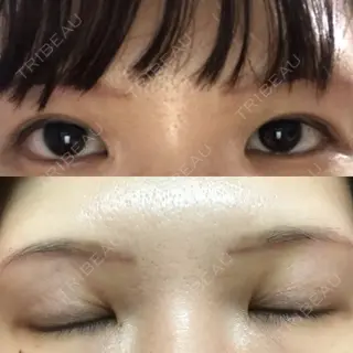9日目の経過画像（1枚目）
