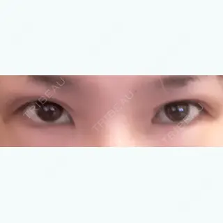 7日目の経過画像（1枚目）