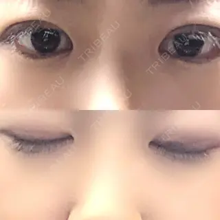 9日目の経過画像（1枚目）