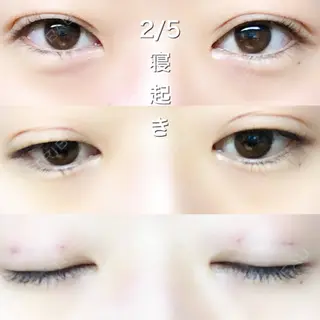 2日目の経過画像（1枚目）