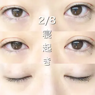 5日目の経過画像（1枚目）