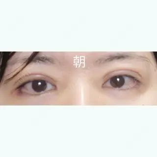 2日目の経過画像（1枚目）