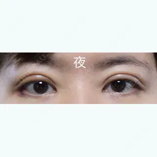 2日目の経過画像（2枚目）