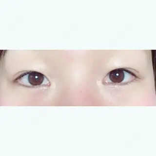 12日目の経過画像（1枚目）