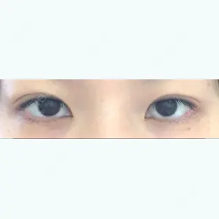 5日目の経過画像（1枚目）