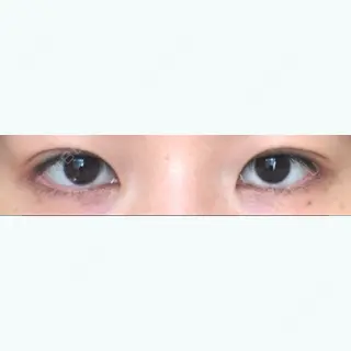 7日目の経過画像（1枚目）