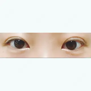 69日目の経過画像（1枚目）
