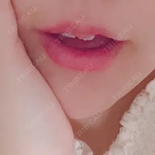 4日目の経過画像（3枚目）