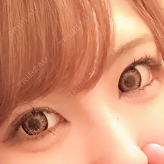 31日目の経過画像（3枚目）