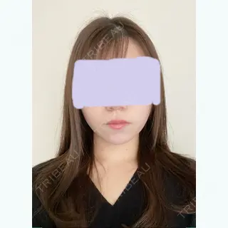 334日目の経過画像（1枚目）