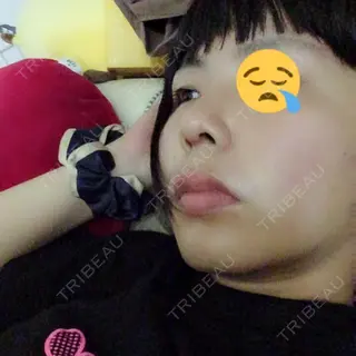 26日目の経過画像（1枚目）