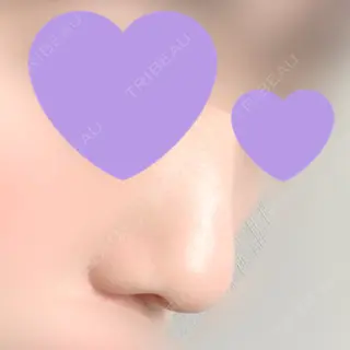 360日目の経過画像（2枚目）