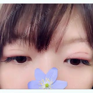 3日目の経過画像（2枚目）