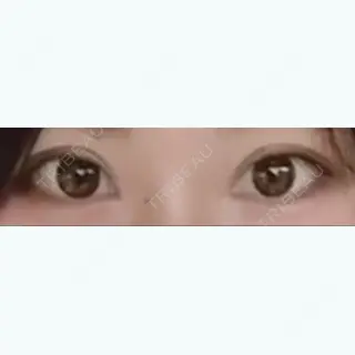 92日目の経過画像（2枚目）