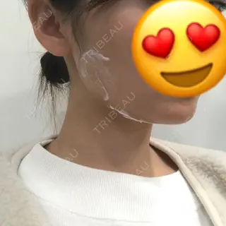 0日目の経過画像（2枚目）