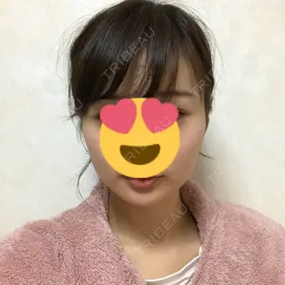 5日目の経過画像（1枚目）