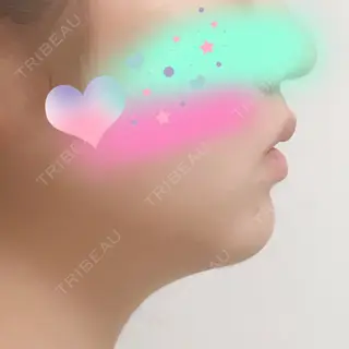 6日目の経過画像（1枚目）