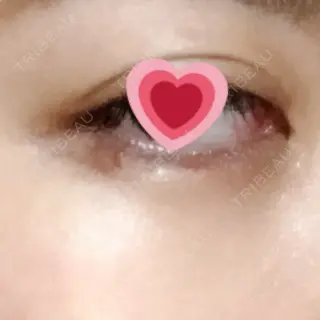 1日目の経過画像（2枚目）