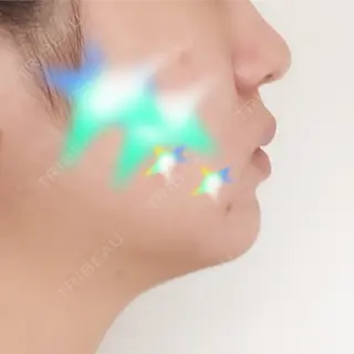 4日目の経過画像（1枚目）