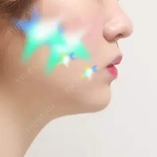 27日目の経過画像（1枚目）
