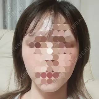 543日目の経過画像（1枚目）
