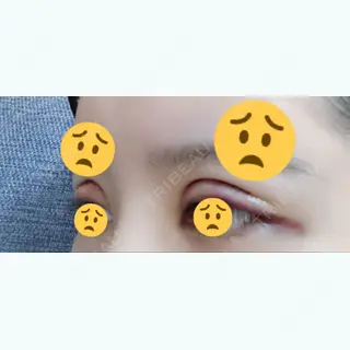 2日目の経過画像（2枚目）