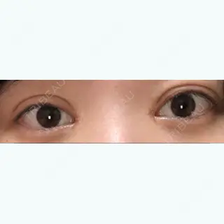 16日目の経過画像（1枚目）