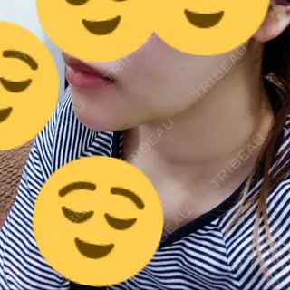 6日目の経過画像（2枚目）