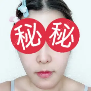14日目の経過画像（1枚目）