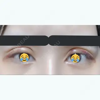 6日目の経過画像（1枚目）