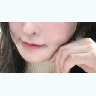 27日目の経過画像（2枚目）