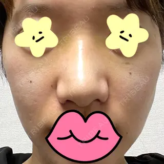 3日目の経過画像（1枚目）
