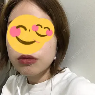 109日目の経過画像（3枚目）