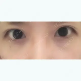 4264日目の経過画像（2枚目）