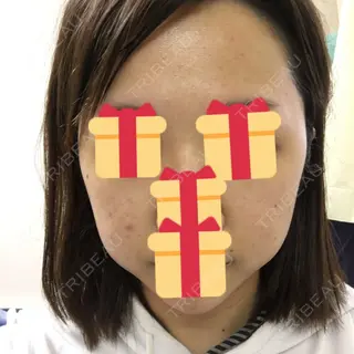 5日目の経過画像（3枚目）