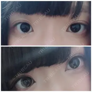 30日目の経過画像（1枚目）