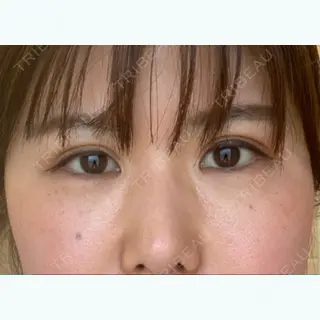 462日目の経過画像（2枚目）