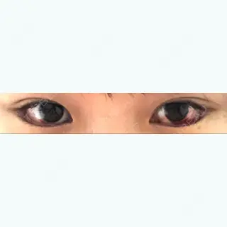 3日目の経過画像（1枚目）