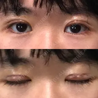 3日目の経過画像（1枚目）