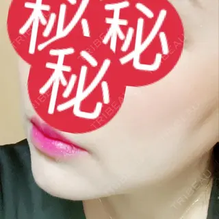 17日目の経過画像（2枚目）