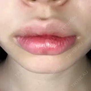 10日目の経過画像（1枚目）