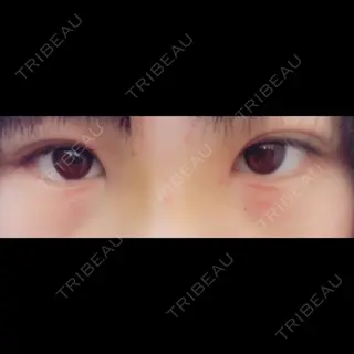 3日目の経過画像（1枚目）