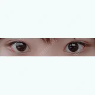7日目の経過画像（1枚目）