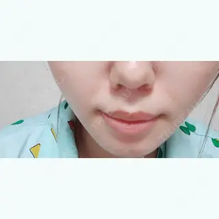 380日目の経過画像（1枚目）