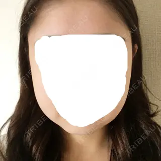 3日目の経過画像（1枚目）