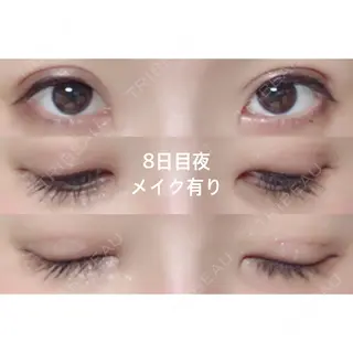 8日目の経過画像（1枚目）