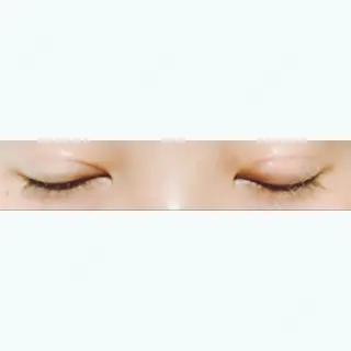 95日目の経過画像（2枚目）